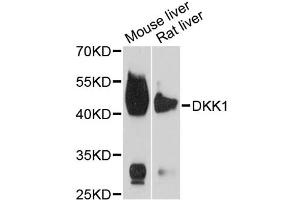 Western blot analysis of extracts of various cell lines, using DKK1 antibody (ABIN5971387) at 1/1000 dilution. (DKK1 抗体)