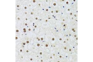 Immunohistochemistry of paraffin-embedded human liver using DDB1 Antibody. (DDB1 抗体)