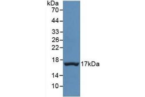 Detection of Recombinant TTR, Human using Monoclonal Antibody to Prealbumin (PALB) (TTR 抗体  (AA 21-147))