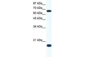 WB Suggested Anti-CUL1 Antibody Titration:  1. (Cullin 1 抗体  (C-Term))