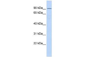 TIPARP antibody used at 1 ug/ml to detect target protein. (Tiparp 抗体)