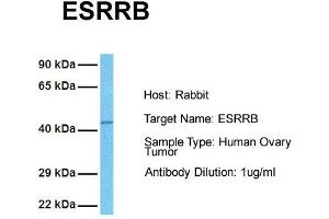 Host: Rabbit Target Name: ESRRB Sample Tissue: Human Ovary Tumor Antibody Dilution: 1. (ESRRB 抗体  (N-Term))