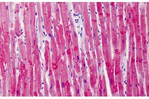 Human Heart: Formalin-Fixed, Paraffin-Embedded (FFPE) (Cardiac Troponin T2 抗体  (AA 146-160))