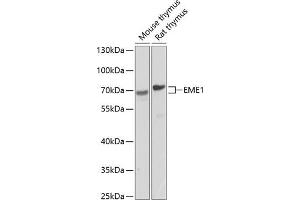 Western blot analysis of extracts of various cell lines, using EME1 antibody (ABIN6127301, ABIN6140155, ABIN6140156 and ABIN6224416) at 1:1000 dilution. (Crossover junction endonuclease EME1 (EME1) (AA 1-320) 抗体)
