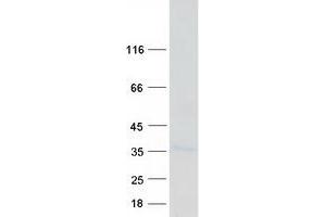 Western Blotting (WB) image for BCL2-Like 12 (Proline Rich) (BCL2L12) (Transcript Variant 1) protein (Myc-DYKDDDDK Tag) (ABIN2715194)