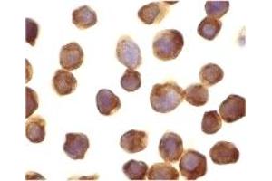 Immunohistochemistry (IHC) image for anti-Death-Associated Protein Kinase 3 (DAPK3) (Middle Region) antibody (ABIN1031183) (DAPK3 抗体  (Middle Region))