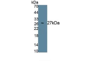 Detection of Recombinant KLK3, Rat using Polyclonal Antibody to Prostate Specific Antigen (PSA) (Prostate Specific Antigen 抗体  (AA 68-255))