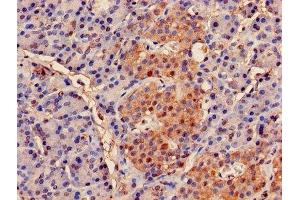 Immunohistochemistry of paraffin-embedded human pancreatic tissue using ABIN7164973 at dilution of 1:100 (PSMB2 抗体  (AA 1-201))