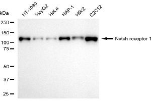 Western blotting analysis using notch receptor 1 antibody (ABIN7799625). (Recombinant Notch1 抗体)