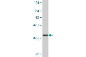 Western Blot detection against Immunogen (36. (NAGS 抗体  (AA 435-532))