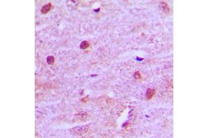 Immunohistochemistry (IHC) image for anti-Menage A Trois Homolog 1, Cyclin H Assembly Factor (Xenopus Laevis) (MNAT1) (Center) antibody (ABIN7296338)