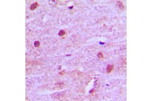 Immunohistochemical analysis of MNAT1 staining in human brain formalin fixed paraffin embedded tissue section. (MNAT1 抗体  (Center))