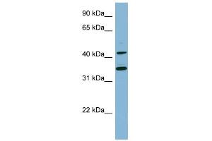 WB Suggested Anti-BLNK Antibody Titration:  0. (B-Cell Linker 抗体  (Middle Region))