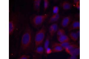 Immunofluorescence staining of methanol-fixed HeLa cells using NF-κB p105/p50 (phospho- Ser893) antibody (E011018 Red). (NFKB1 抗体  (pSer893))