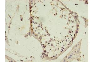 Immunohistochemistry of paraffin-embedded human testis tissue using ABIN7150209 at dilution of 1:100 (MSH6 抗体  (AA 1-400))