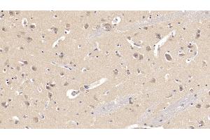 Immunohistochemistry (IHC) image for anti-Sema Domain, Immunoglobulin Domain (Ig), Short Basic Domain, Secreted, (Semaphorin) 3A (SEMA3A) (AA 580-664) antibody (ABIN7428446)