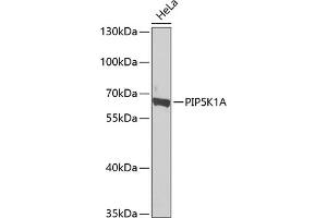 Western blot analysis of extracts of HeLa cells, using PIP5K1A antibody  at 1:1000 dilution. (PIP5K1A 抗体  (AA 231-500))