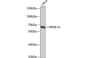 Western Blotting (WB) image for anti-Phosphatidylinositol-4-Phosphate 5-Kinase, Type I, alpha (PIP5K1A) (AA 231-500) antibody (ABIN6145681)