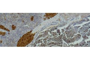 Immunohistochemistry of paraffin-embedded Mouse spleen tissue using IL2RA Monoclonal Antibody at dilution of 1:500 . (CD25 抗体)