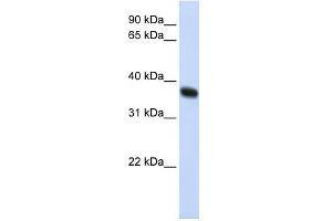 WB Suggested Anti-ZNF364 Antibody Titration:  0. (RNF115 抗体  (C-Term))