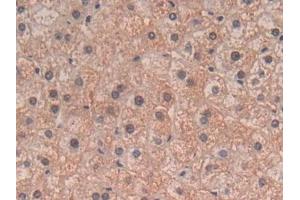 Detection of TGFb3 in Human Liver Tissue using Polyclonal Antibody to Transforming Growth Factor Beta 3 (TGFb3) (TGFB3 抗体  (AA 24-300))