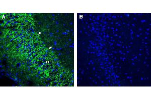 Expression of SV2A in rat hippocampusImmunohistochemical staining of perfusion-fixed frozen rat brain sections using Anti-SV2A Antibody (ABIN7581988), (1:300), followed by goat anti-rabbit-AlexaFluor-488. (SV2A 抗体  (Intracellular))