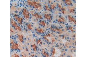 Used in DAB staining on fromalin fixed paraffin- embedded stomach tissue (MCCC2 抗体  (AA 380-563))