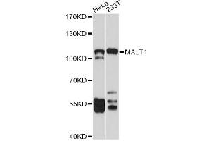 Western blot analysis of extracts of various cell lines, using MALT1 antibody (ABIN5971171) at 1/1000 dilution.
