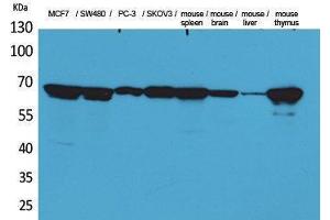 Western Blotting (WB) image for anti-Lamin B1 (LMNB1) (Internal Region) antibody (ABIN6283615) (Lamin B1 抗体  (Internal Region))