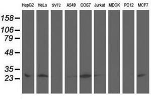 Image no. 3 for anti-Adenylate Kinase 4 (AK4) antibody (ABIN1496524) (AK4 抗体)