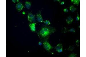 Anti-CRYAB mouse monoclonal antibody (ABIN2452579) immunofluorescent staining of COS7 cells transiently transfected by pCMV6-ENTRY CRYAB (RC202718). (CRYAB 抗体)