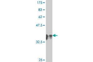 Western Blot detection against Immunogen (37. (DNASE2 抗体  (AA 261-360))