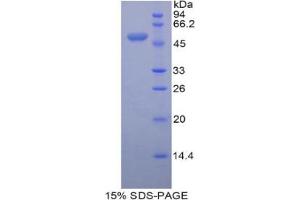 SDS-PAGE analysis of Mouse Peroxiredoxin 3 Protein.