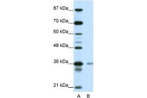 WB Suggested Anti-HIF1AN Antibody Titration:  0. (HIF1AN 抗体  (N-Term))