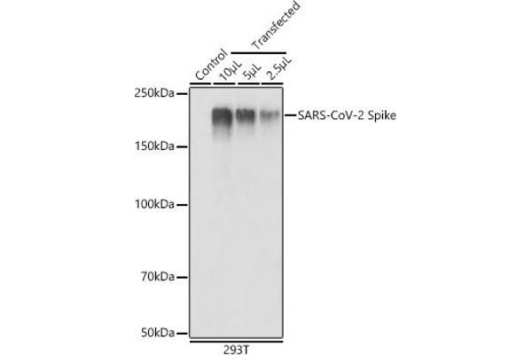 Coronavirus Spike Glycoprotein 抗体