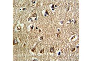 IHC analysis of FFPE human brain tissue stained with RAN antibody (RAN 抗体  (AA 12-39))