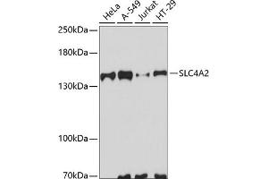 Western blot analysis of extracts of various cell lines, using SLC4 antibody (ABIN6129885, ABIN6148011, ABIN6148012 and ABIN6223666) at 1:3000 dilution. (SLC4A2 抗体  (AA 200-300))