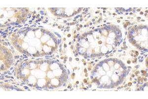 Detection of PLCd4 in Human Colon Tissue using Polyclonal Antibody to Phospholipase C Delta 4 (PLCd4) (PLCD4 抗体  (AA 1-250))