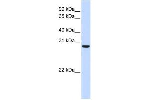 WB Suggested Anti-C18orf10 Antibody Titration: 0. (TPGS2 抗体  (Middle Region))