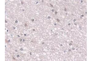 Immunohistochemistry (IHC) image for anti-Proteasome (Prosome, Macropain) Subunit, beta Type, 8 (Large Multifunctional Peptidase 7) (PSMB8) (AA 75-261) antibody (ABIN7440236)