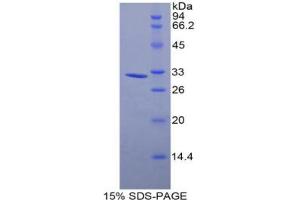 SDS-PAGE analysis of Mouse MYLK3 Protein.