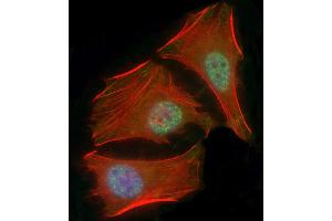 Immunofluorescent analysis of 4 % paraforldehyde-fixed, 0. (SMAD1 抗体  (AA 20-330))