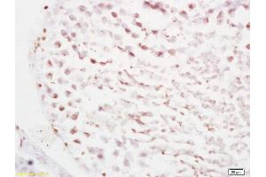 Formalin-fixed and paraffin embedded rat testis tissue labeled with Anti RBBP6/P2P-R Polyclonal Antibody, Unconjugated (ABIN687202) at 1:200 followed by conjugation to the secondary antibody and DAB staining (RBBP6 抗体  (AA 2-150))