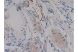 Detection of FGA in Human Stomach Tissue using Polyclonal Antibody to Fibrinogen Alpha Chain (FGA) (FGA 抗体  (AA 124-214))