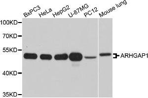 Western blot analysis of extracts of various cell lines, using ARHGAP1 antibody (ABIN5971927) at 1/1000 dilution. (ARHGAP1 抗体)