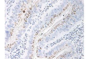 Image no. 1 for anti-Chemokine (C-X-C Motif) Ligand 2 (CXCL2) antibody (ABIN465914) (CXCL2 抗体)