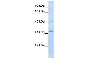 WB Suggested Anti-STUB1 Antibody Titration:  0. (STUB1 抗体  (C-Term))