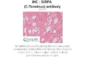 Image no. 2 for anti-Signal-Regulatory Protein alpha (SIRPA) antibody (ABIN1739273) (SIRPA 抗体)