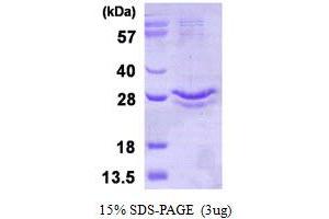 Image no. 1 for Glutathione Peroxidase 3 (Plasma) (GPX3) (AA 21-226), (U73C) protein (His tag) (ABIN668027)