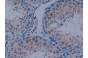 Detection of IkBd in Mouse Testis Tissue using Polyclonal Antibody to Inhibitory Subunit Of NF Kappa B Delta (IkBd) (IkBd 抗体  (AA 58-304))